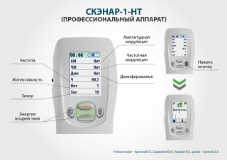 СКЭНАР-1-НТ (исполнение 01)  в Владимире купить Скэнар официальный сайт - denasvertebra.ru 